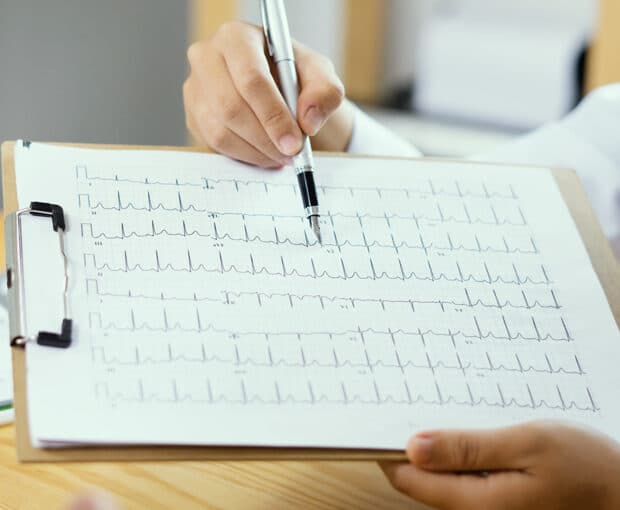 Learn To Read Electrocardiograms – What You Need To Know