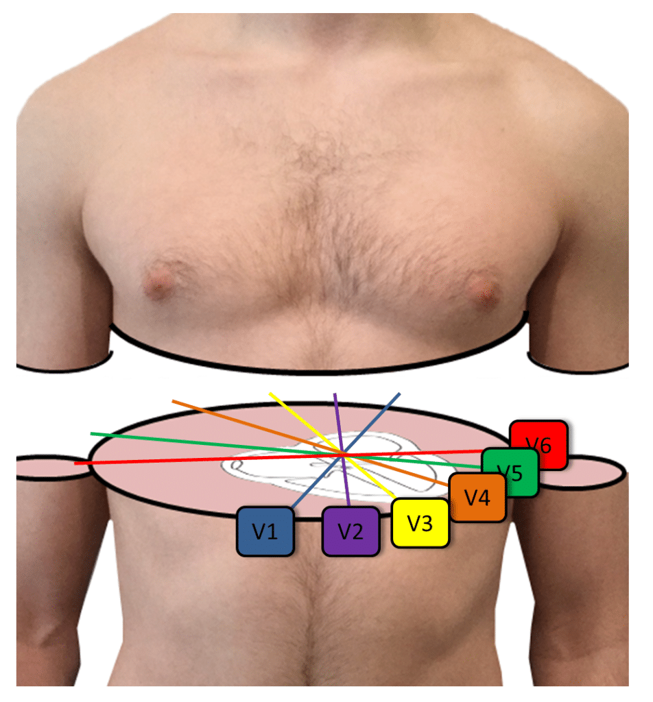 common ecg findings