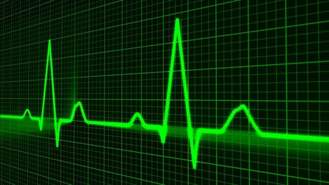 Diagnose & Classify Arrhythmias