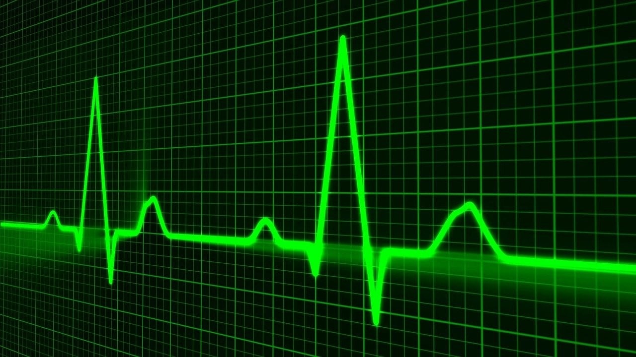 Diagnose & Classify Arrhythmias