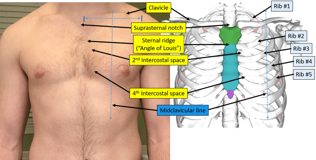 Proper Electrocardiogram (ECG/EKG) Lead Placement