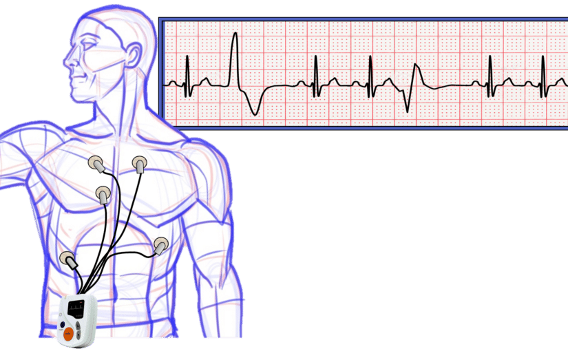 What To Expect From A Good Holter Monitor Reading