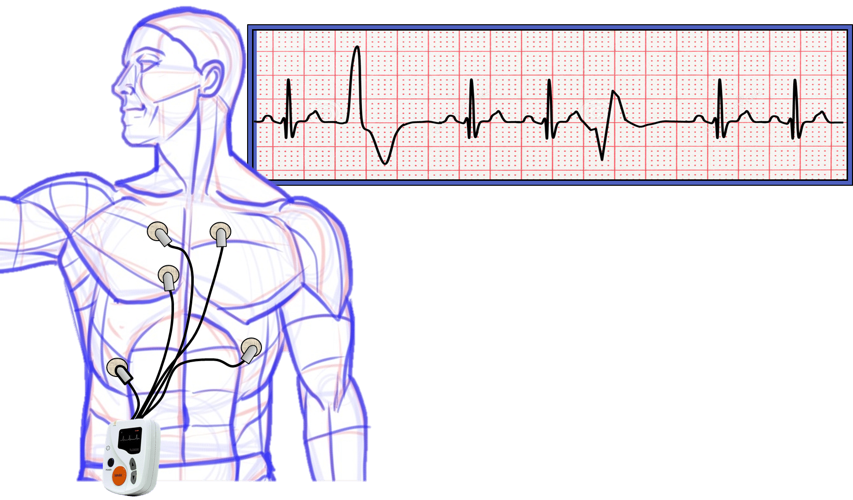 What To Expect From A Good Holter Monitor Reading