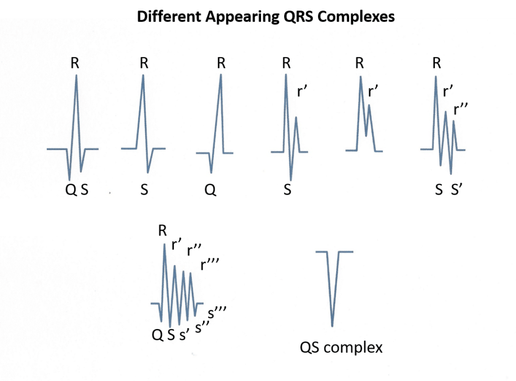 Picture of different-looking QRS complexes