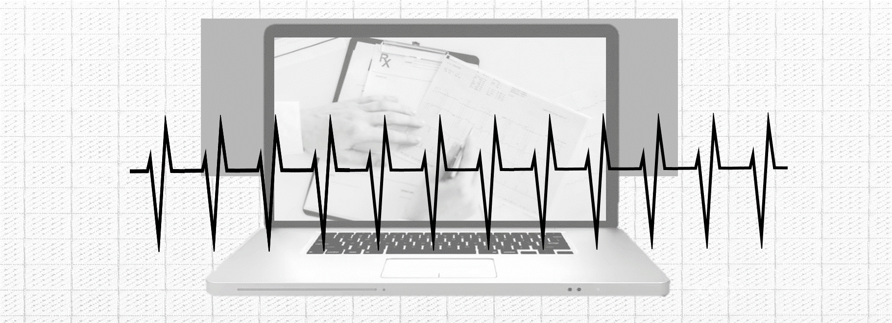 What Is An rSR Prime (rSR’) Pattern On An ECG?