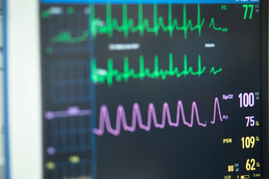 ACLS Rhythms – Learn The Terminology, Definitions, and Pathophysiology