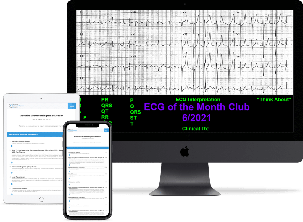 Ecg Program Online Ecg Course : ECG Online Course old – QZUW
