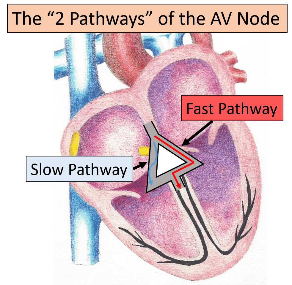 AV node of heart with visual representation of the fast and slow pathways