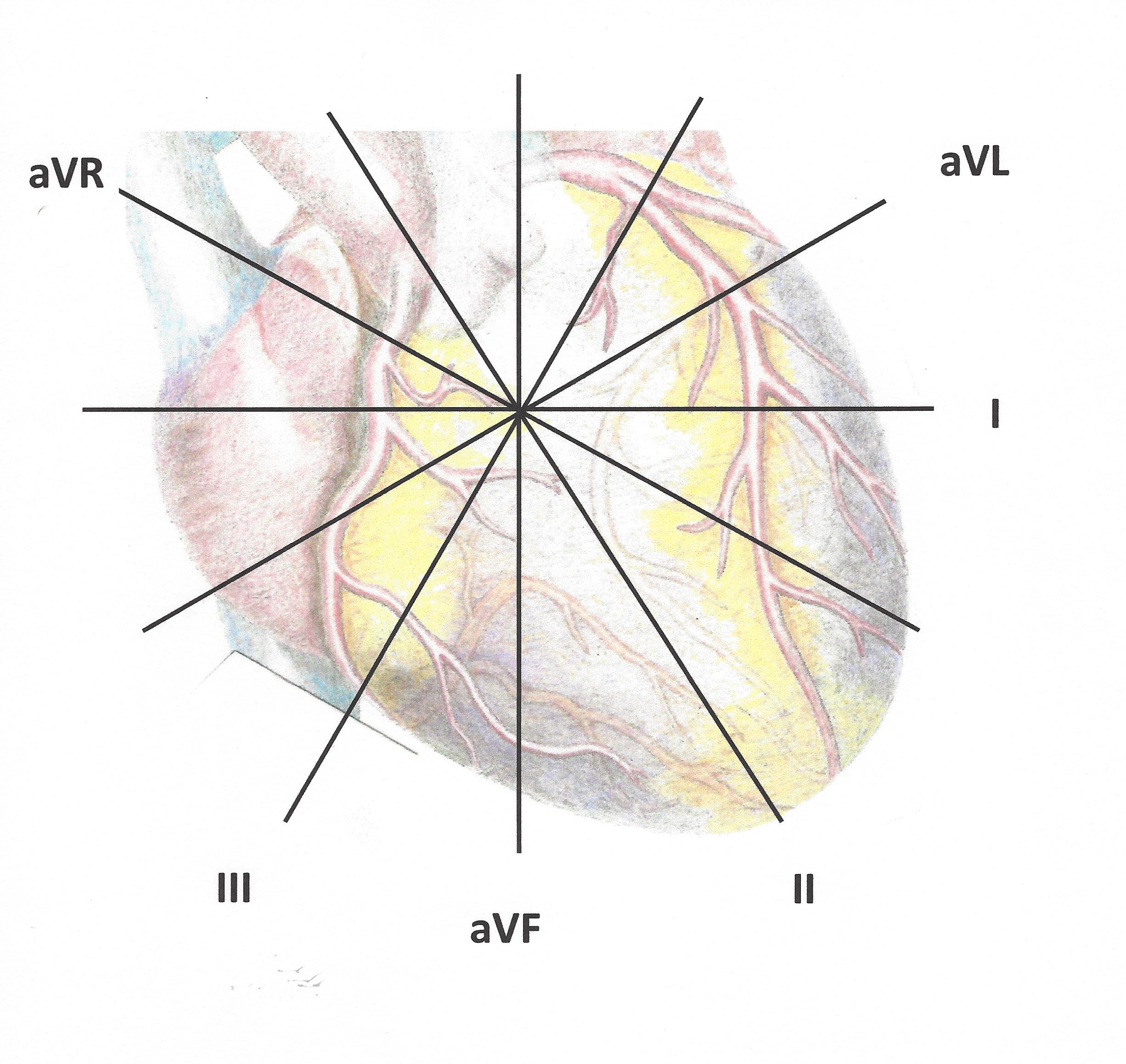 Image of human heart from an anterior view with the limb lead axis superimposed