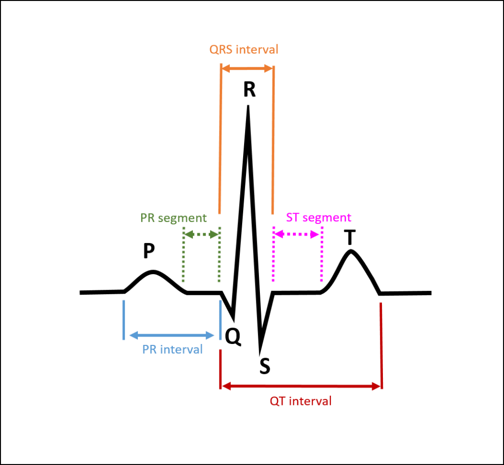 ECG waveform showing the P wave, Q wave, R wave, S wave, PR segment, ST segment, PR interval, QRS interval, and QT interval.