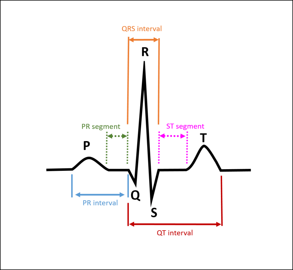 How To Read An ECG The ECGEDU Approach To Reading EKGs