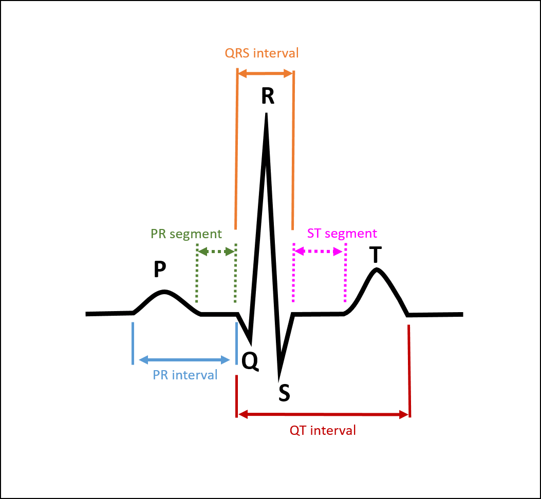 ECG waveform showing the P wave, Q wave, R wave, S wave, PR segment, ST segment, PR interval, QRS interval, and QT interval.