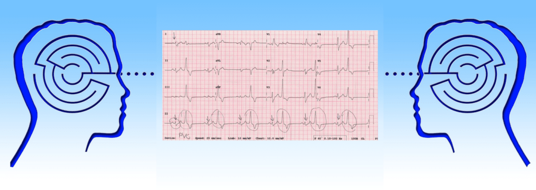 Understanding ECGs – Define, Deduce, and Diagnose (Part 1)