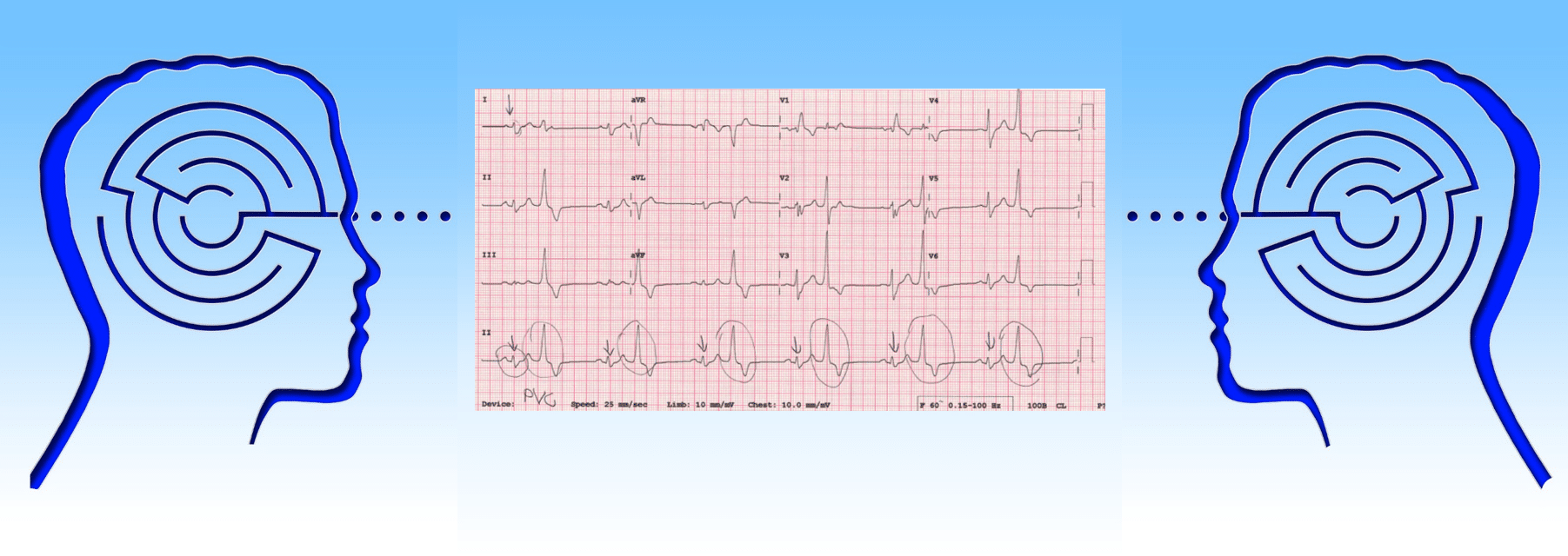 Understanding ECGs – Define, Deduce, and Diagnose (Part 1)