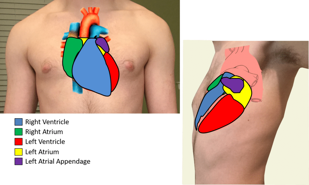 Diagram of the heart in the chest differentiating the different chambers in different colors