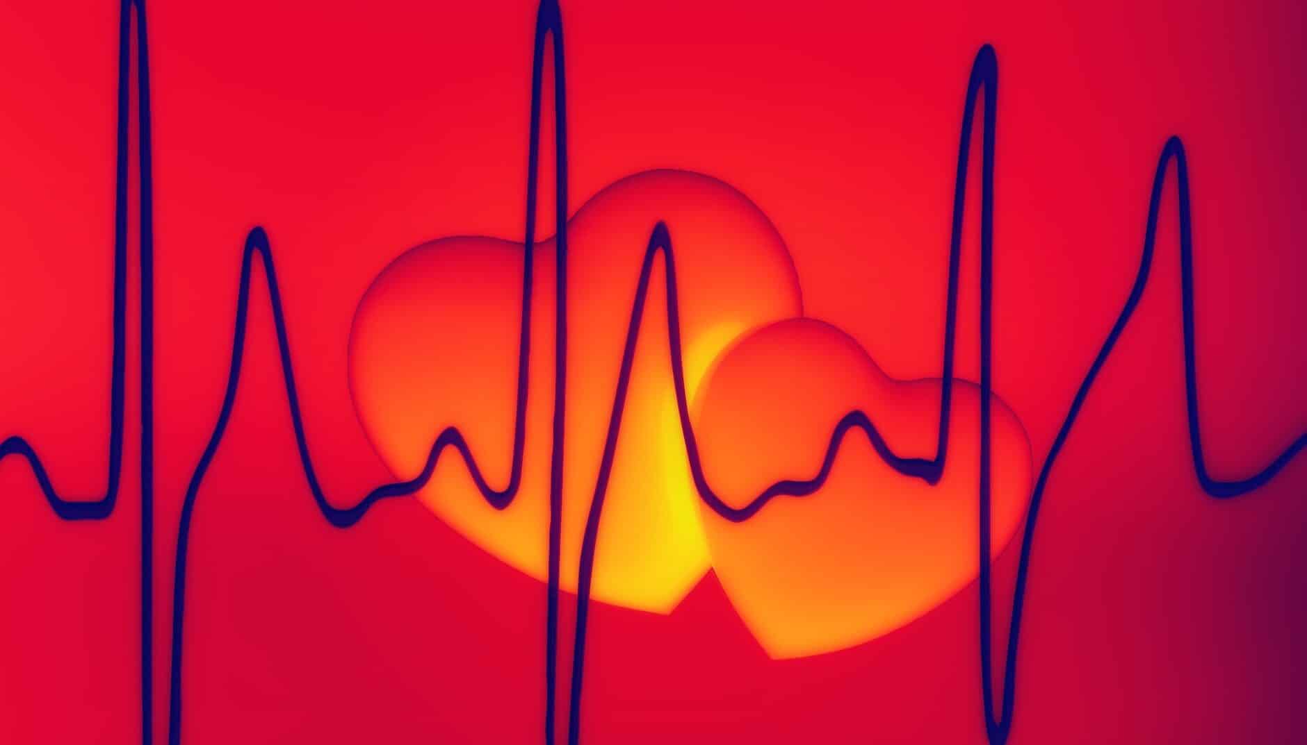 What are Arrhythmias?