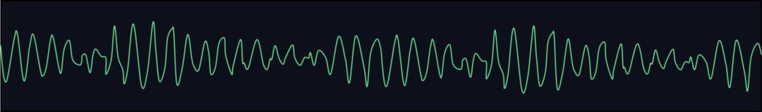 Learning to Interpret 12-Lead ECGs – The Basics