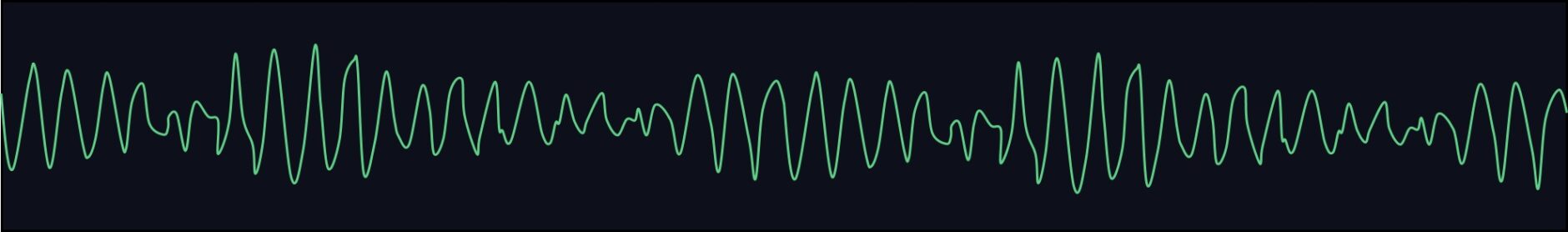 Learning to Interpret 12-Lead ECGs – The Basics