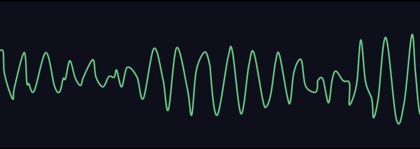 Learning to Interpret 12-Lead ECGs – The Basics