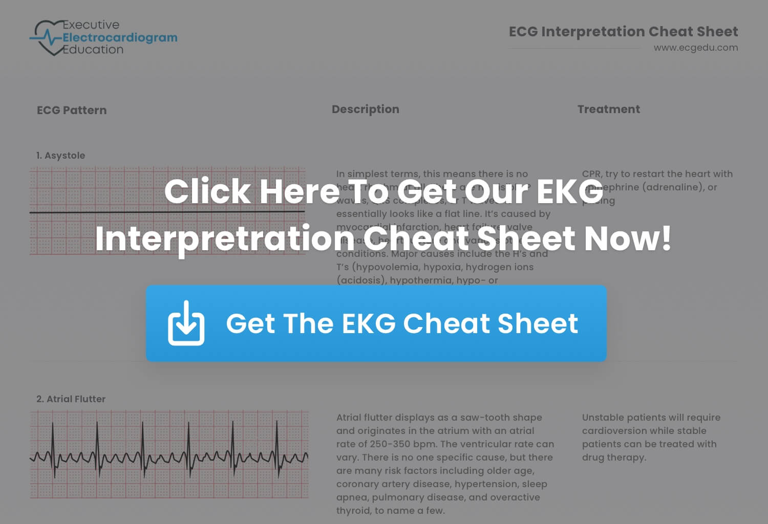 ekg interpretation cheat sheet