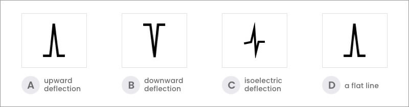 quiz question 1