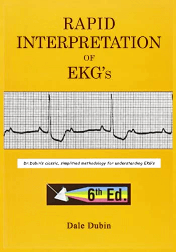 rapid interpretation of ekgs