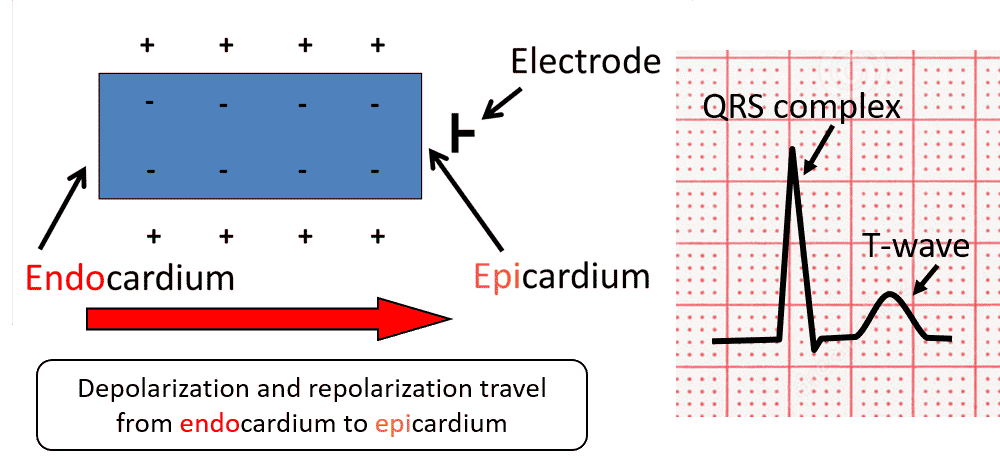 The T-Wave Explained - What Do T Waves On An ECG Represent?