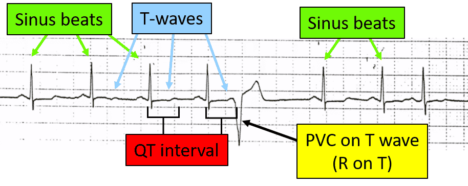 ront, without vt 1.01