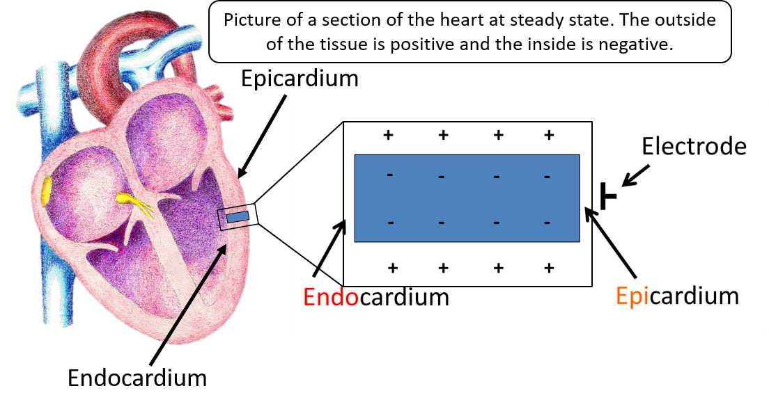 Understanding The Significance Of The T Wave On An ECG