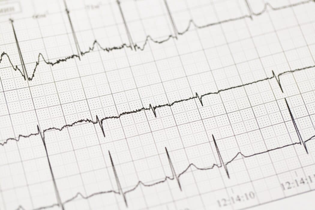 7. EKG Electrocardiogram Nail Design - wide 7