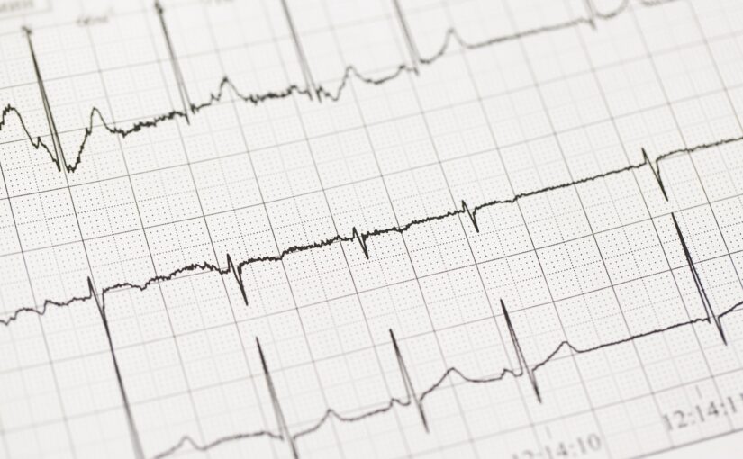 Using Practice EKG Strips To Improve Your EKG Interpretation Skills