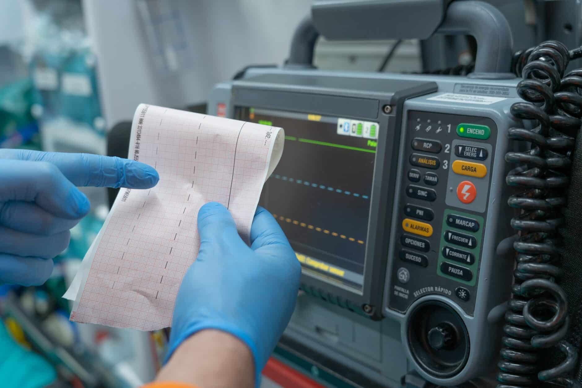 Accurate Recognition of ECG Mimics And Avoiding Misdiagnosis