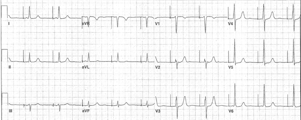 Practice ECG 10