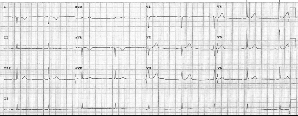 Practice ECG 19