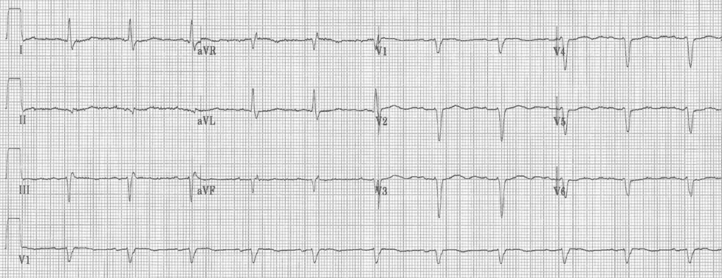 Practice ECG 21