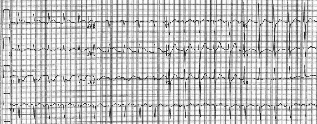 Practice ECG 24