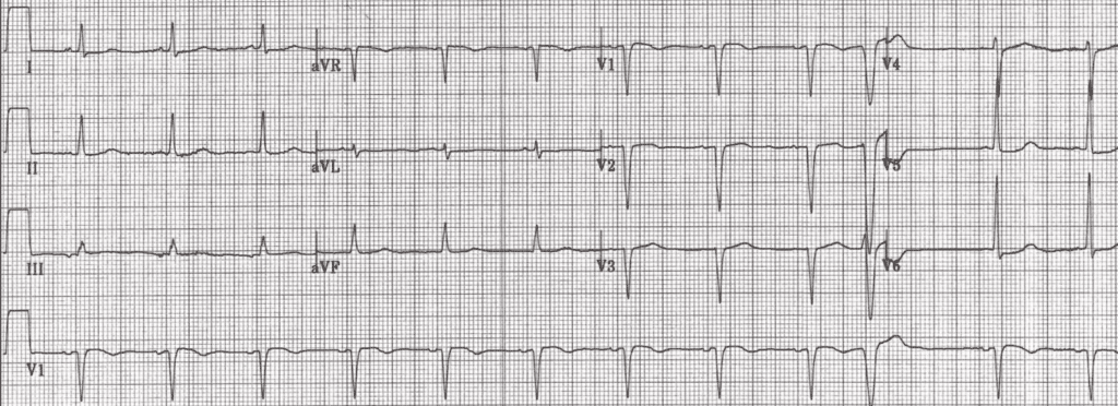 Practice ECG 3