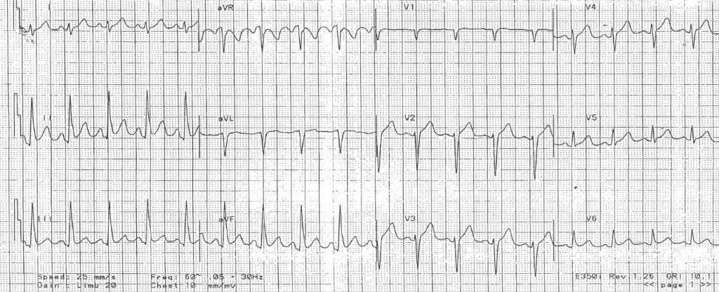 Practice ECG 7