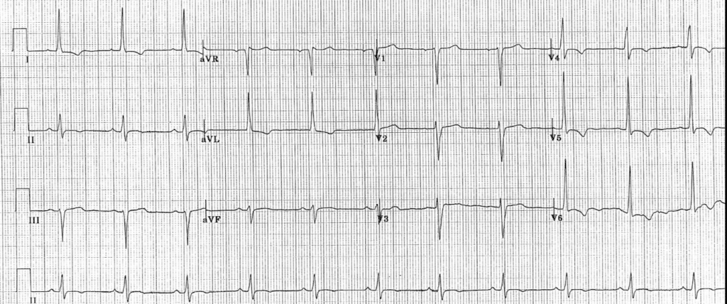 Practice ECG 9